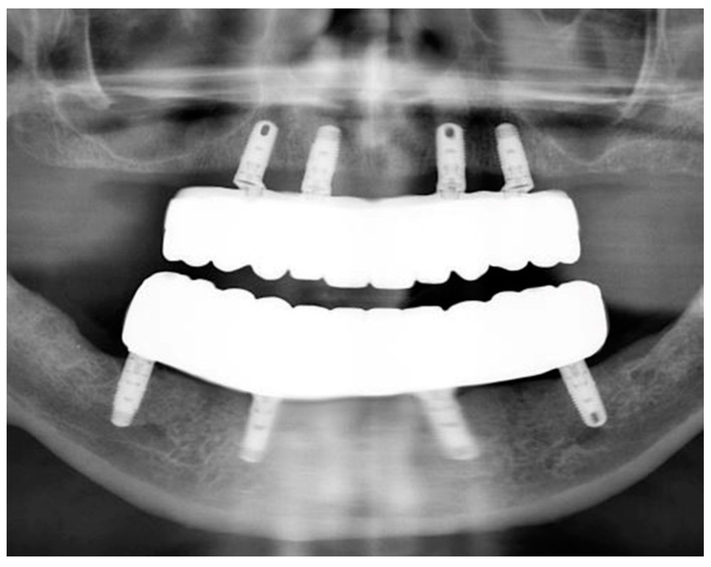 Jfb 14 00174 g010 Jfb 14 00174 g010