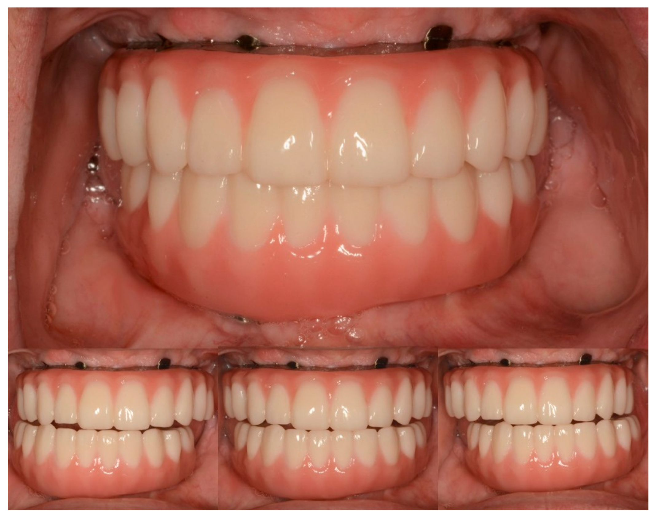 Jfb 14 00174 g011 Jfb 14 00174 g011