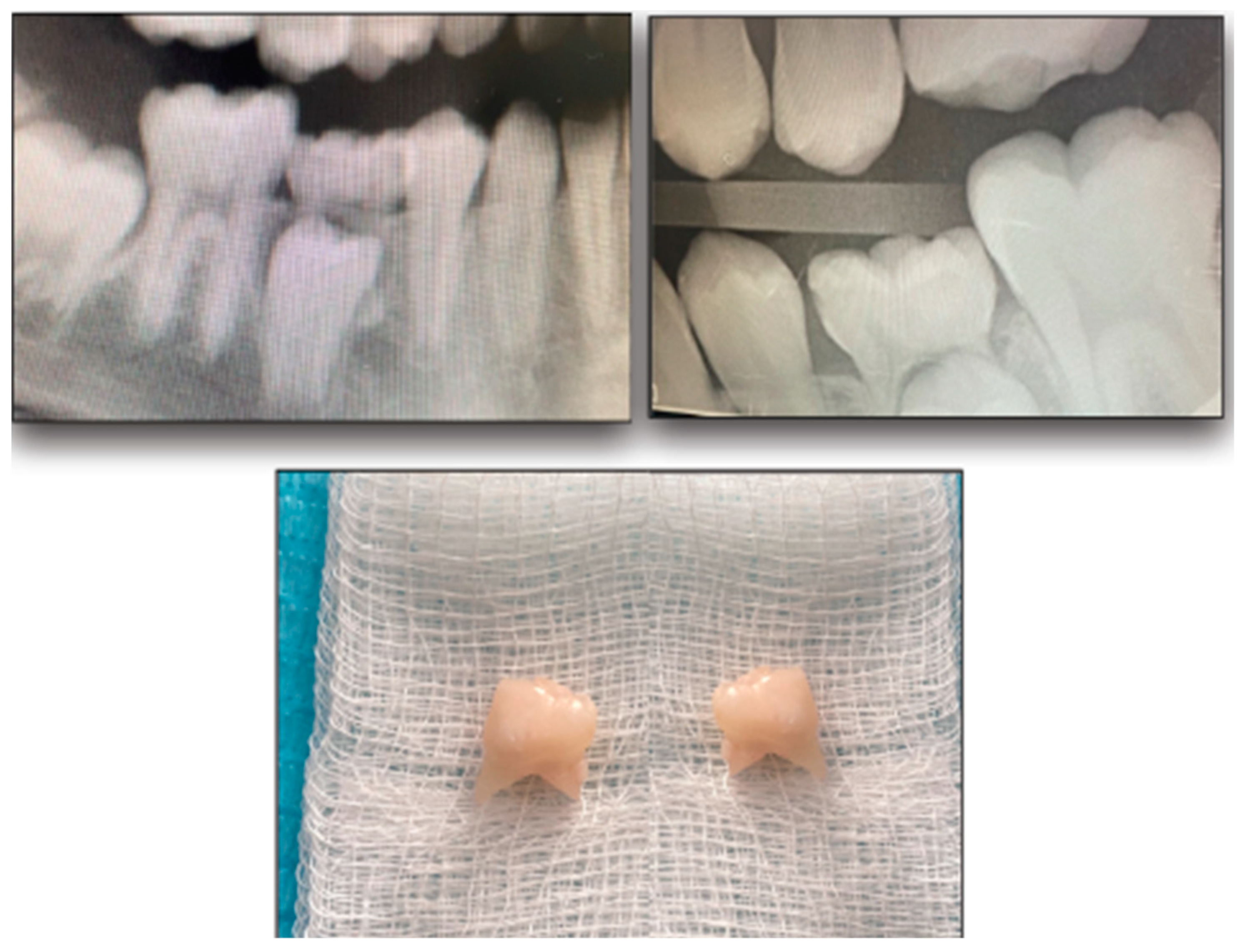 Jfb 15 00017 g002 Jfb 15 00017 g002