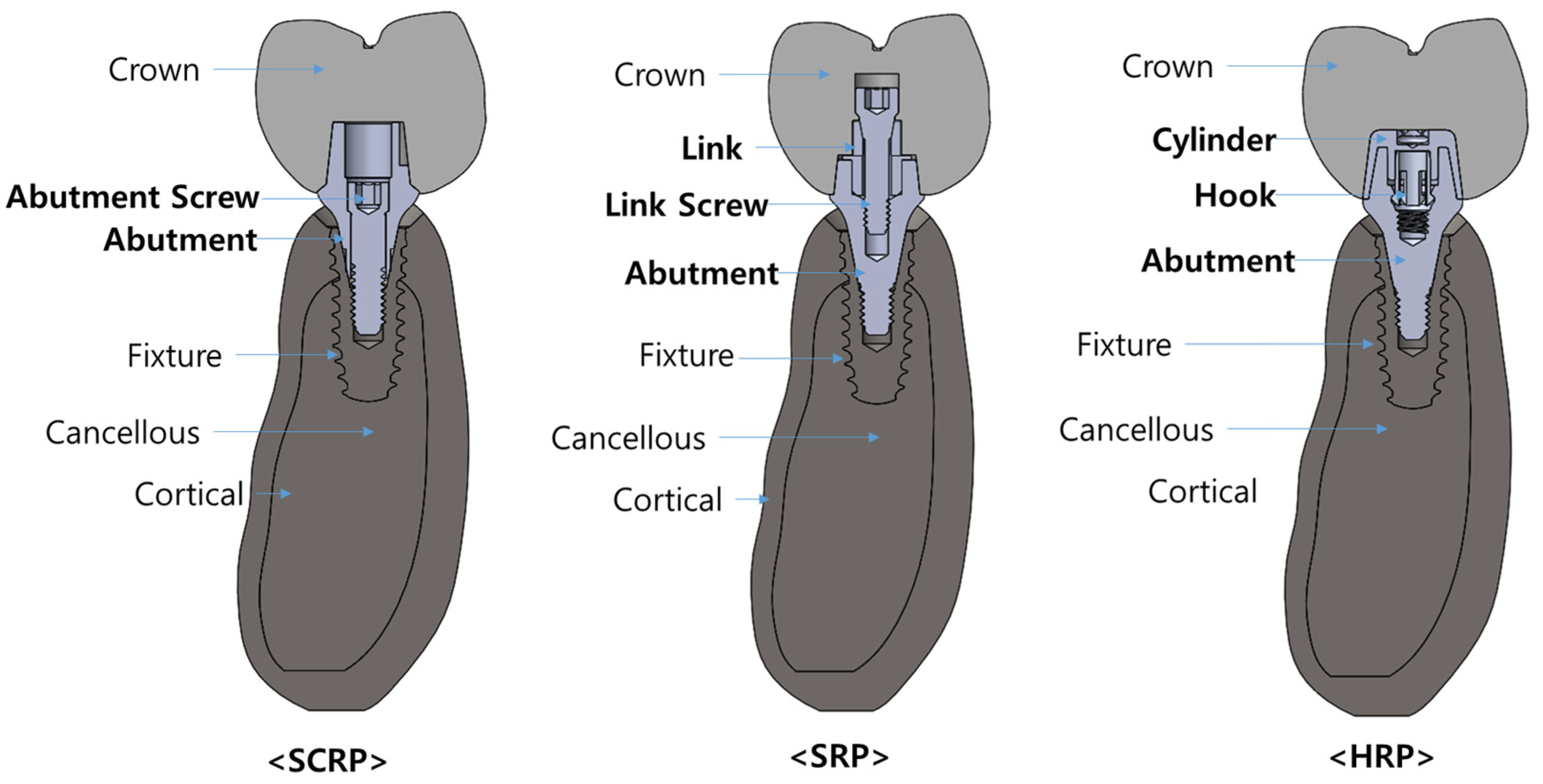 Jfb 16 00039 g002 Jfb 16 00039 g002