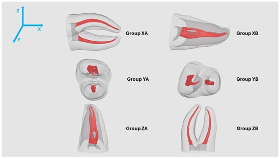 Orientation of the Natural Tooth on the build platform (frontal view) with long-axis parallel to the X, Y and Z Axis and both possible positions of the isthmus.