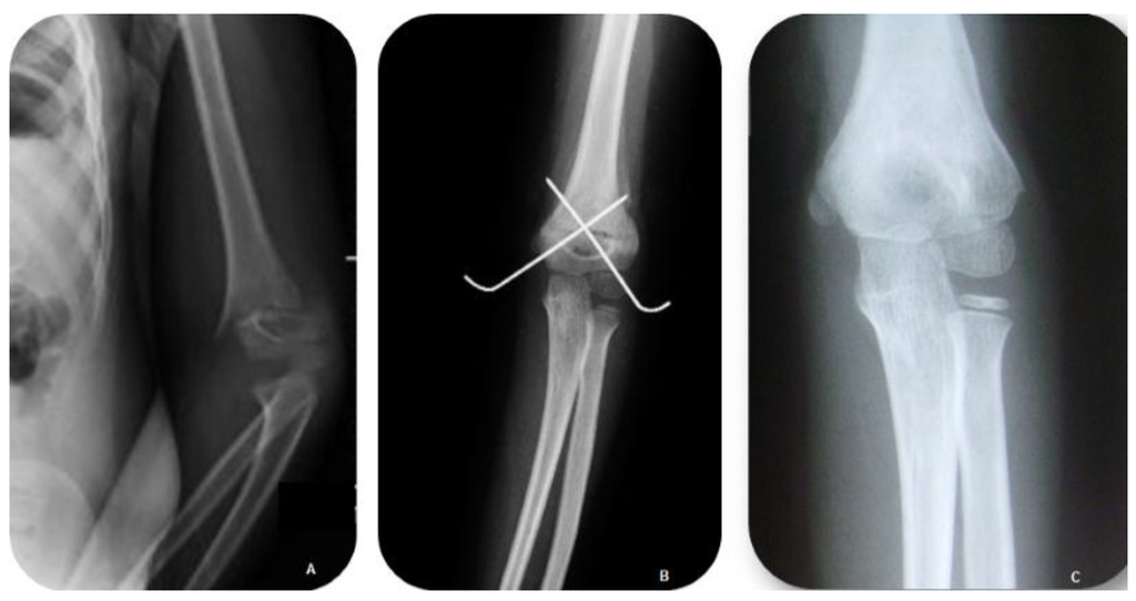 Jfmk 01 00039 g002 1024