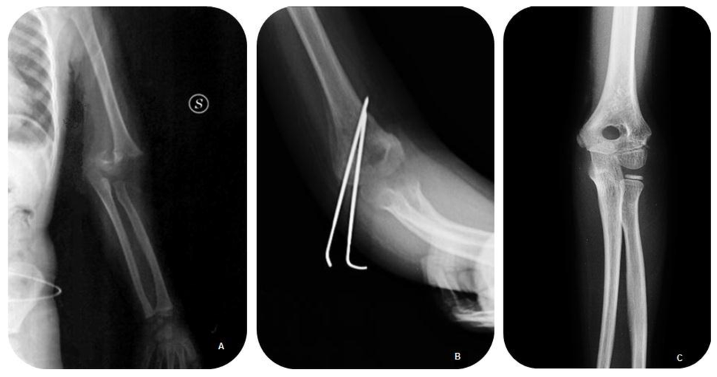 Jfmk 01 00039 g003 1024