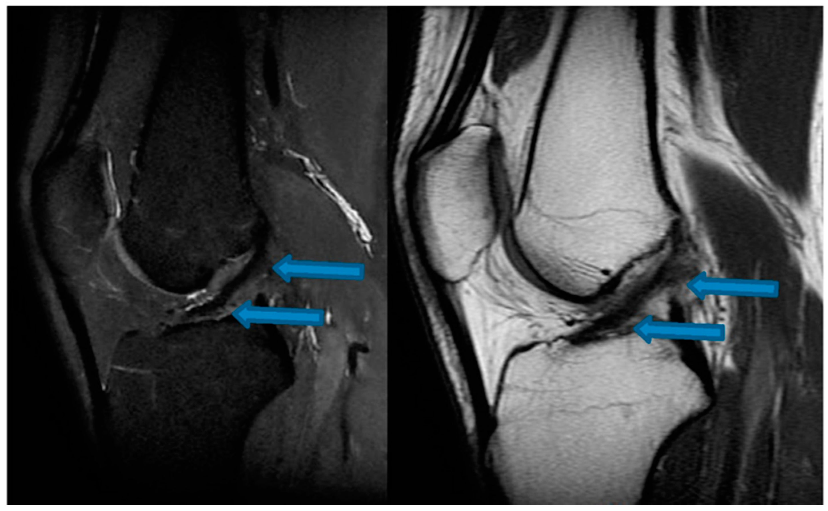 Jfmk 07 00100 g003 Jfmk 07 00100 g003