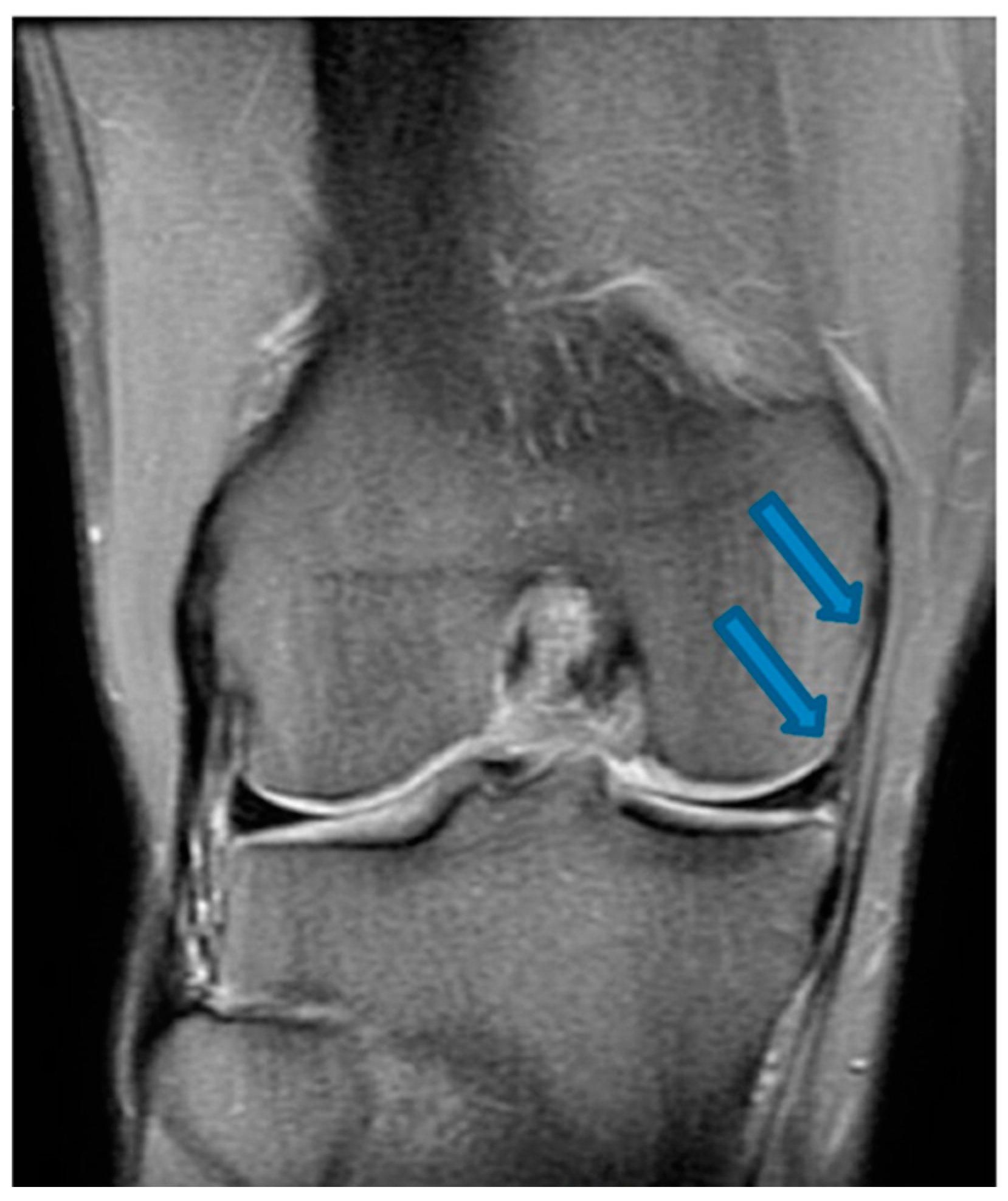 Jfmk 07 00100 g004 Jfmk 07 00100 g004