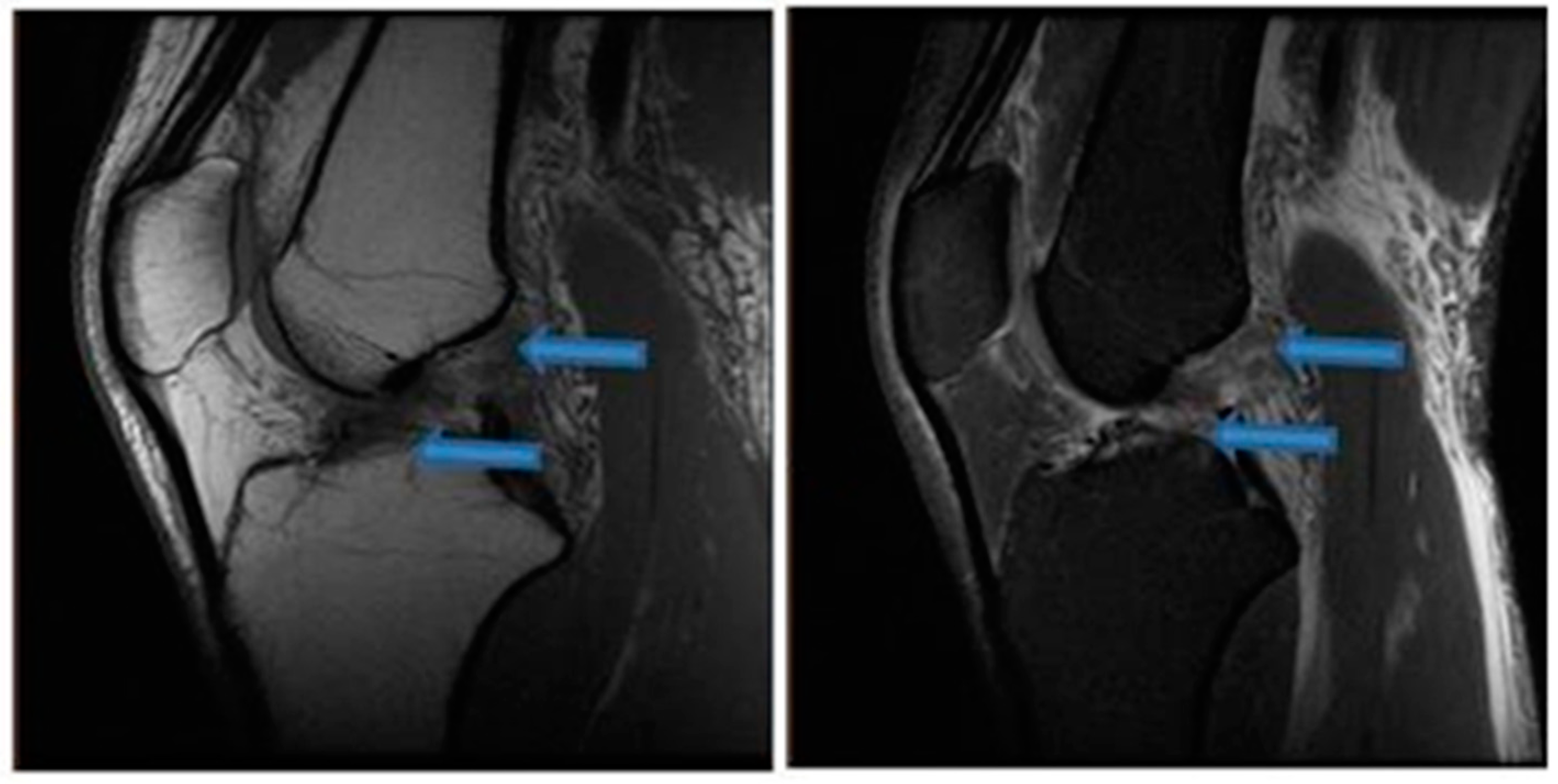 Jfmk 07 00100 g005 Jfmk 07 00100 g005