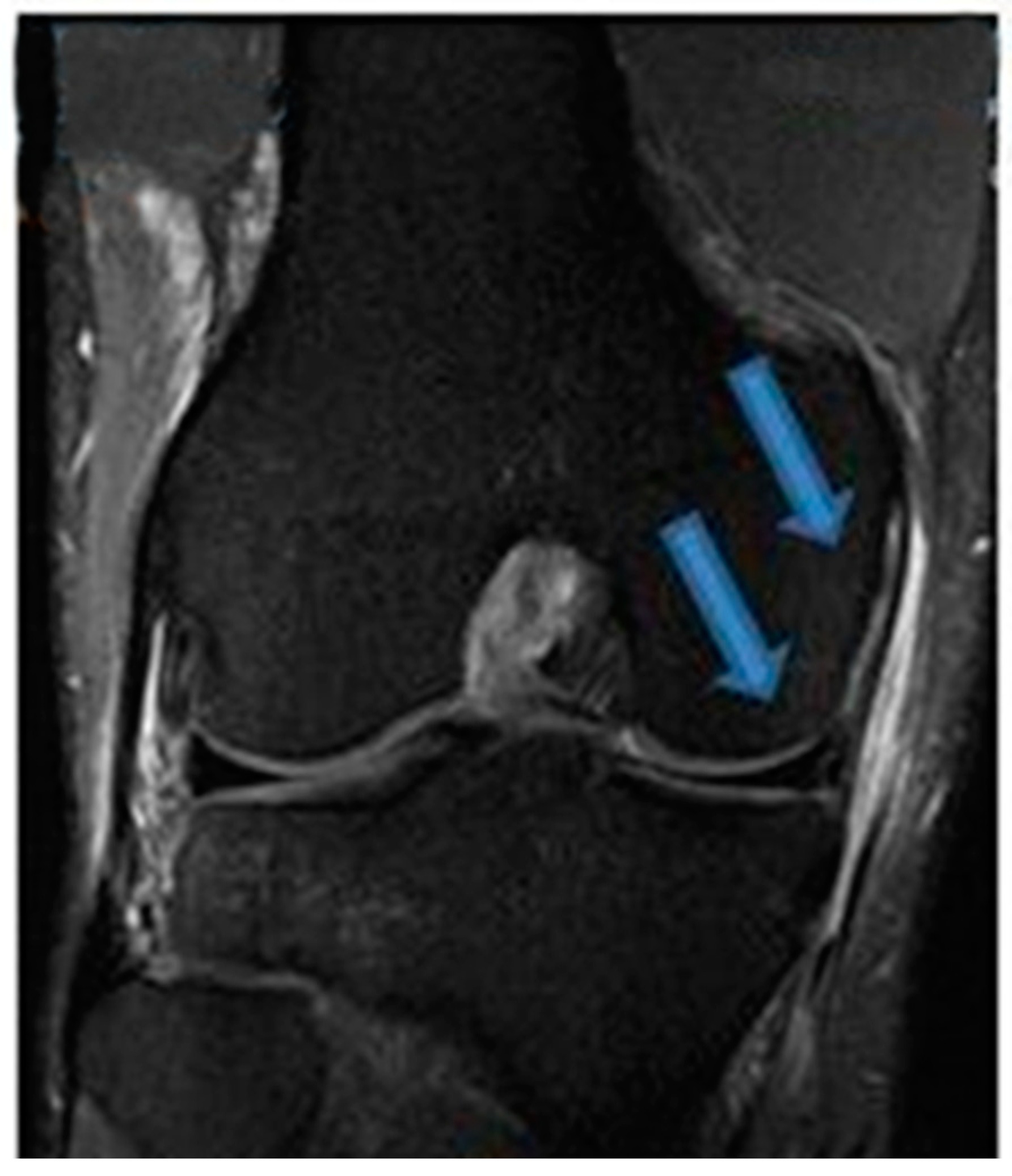 Jfmk 07 00100 g006 Jfmk 07 00100 g006