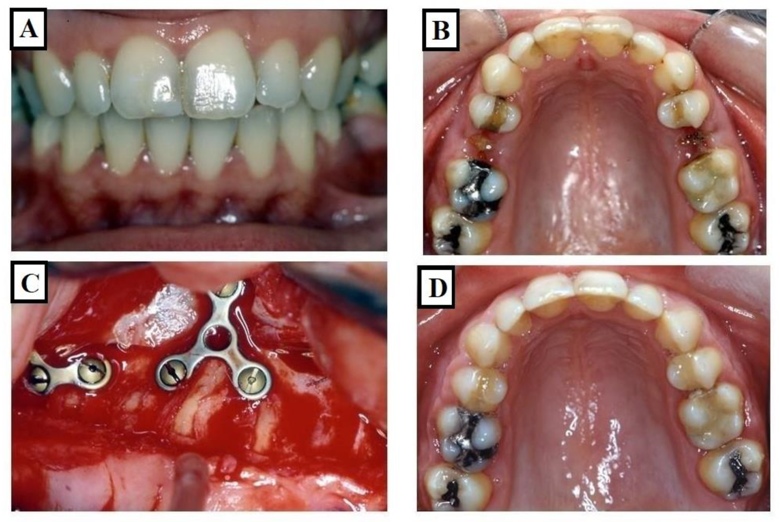 Jfmk 09 00051 g004 Jfmk 09 00051 g004