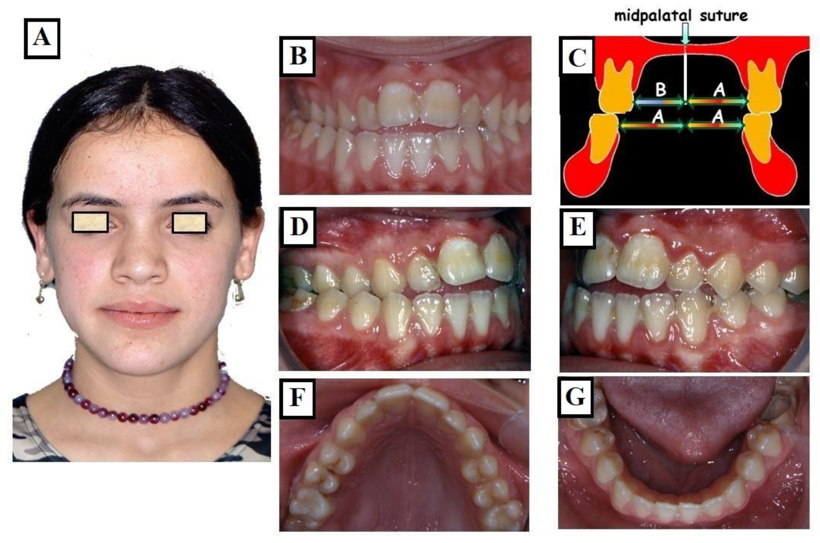 Jfmk 09 00051 g010 Jfmk 09 00051 g010