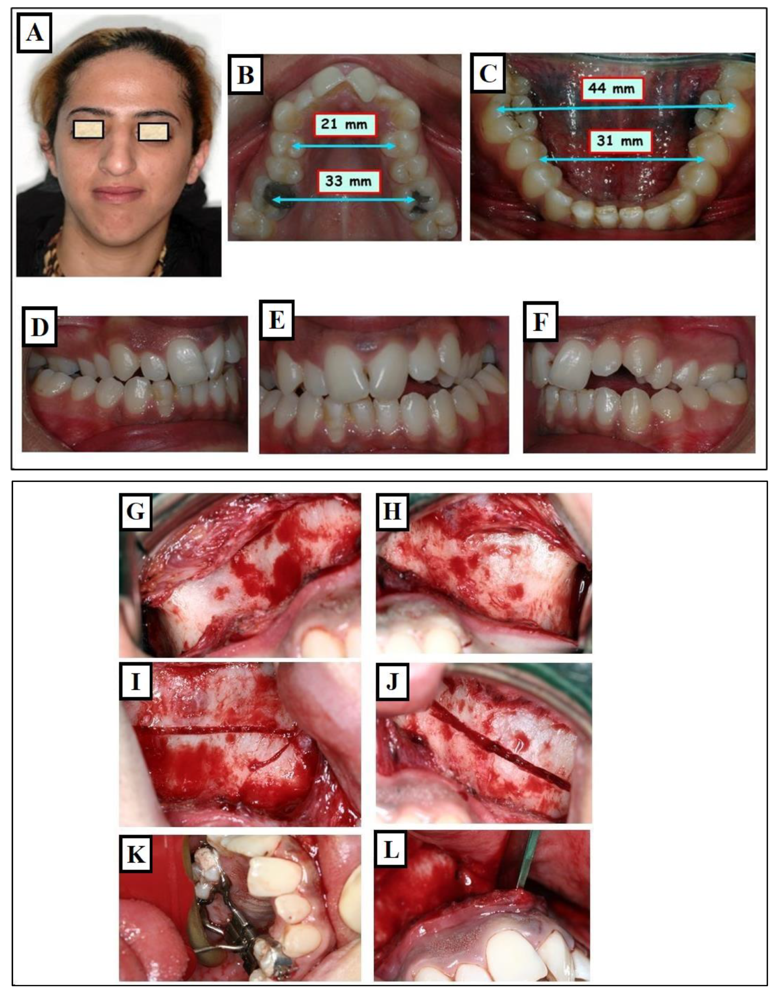 Jfmk 09 00051 g020a Jfmk 09 00051 g020a