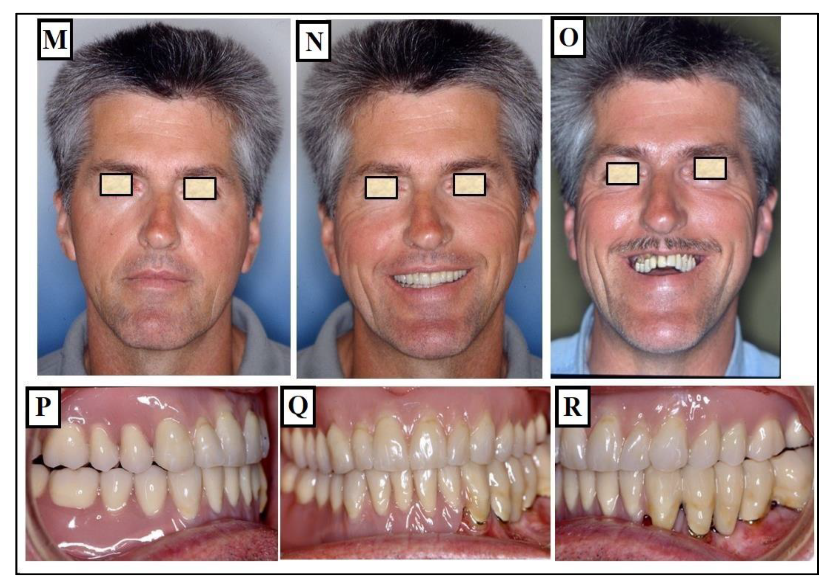 Jfmk 09 00051 g021b Jfmk 09 00051 g021b