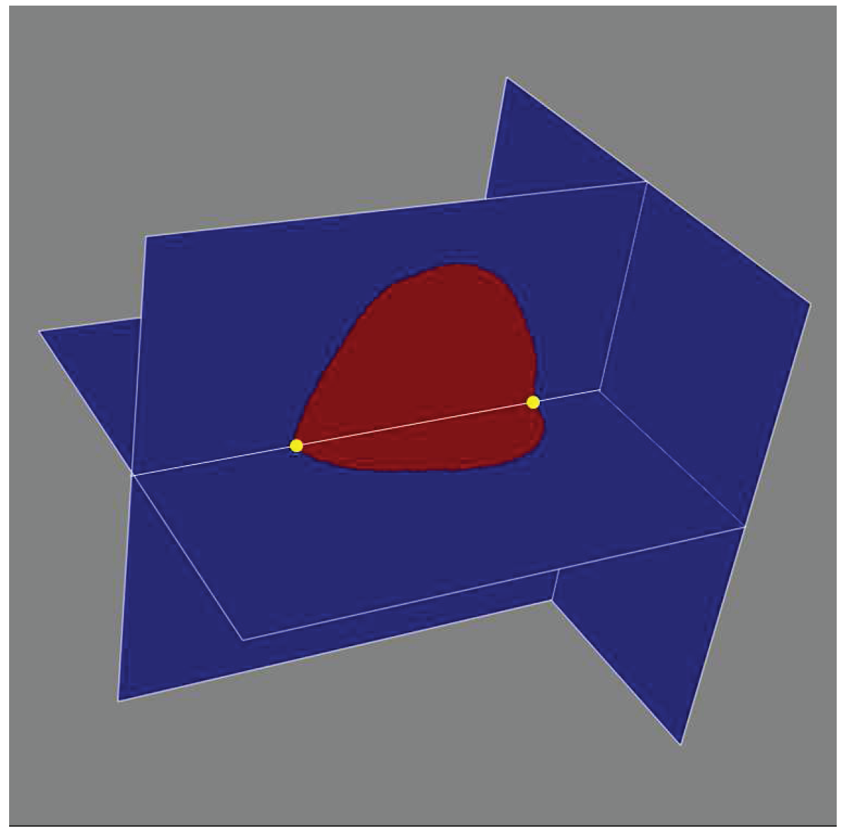 Jimaging 03 00056 g004