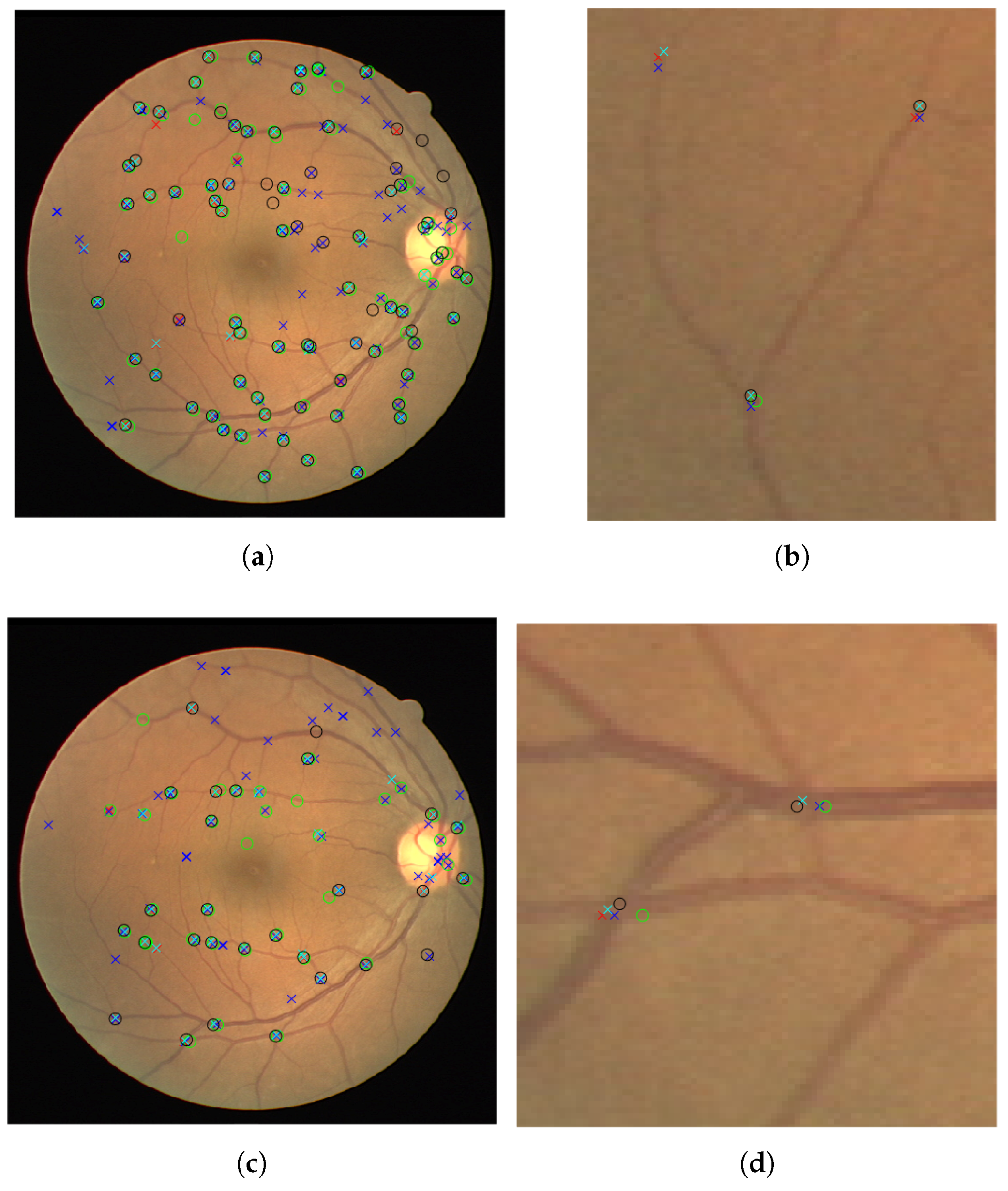 Jimaging 04 00004 g007