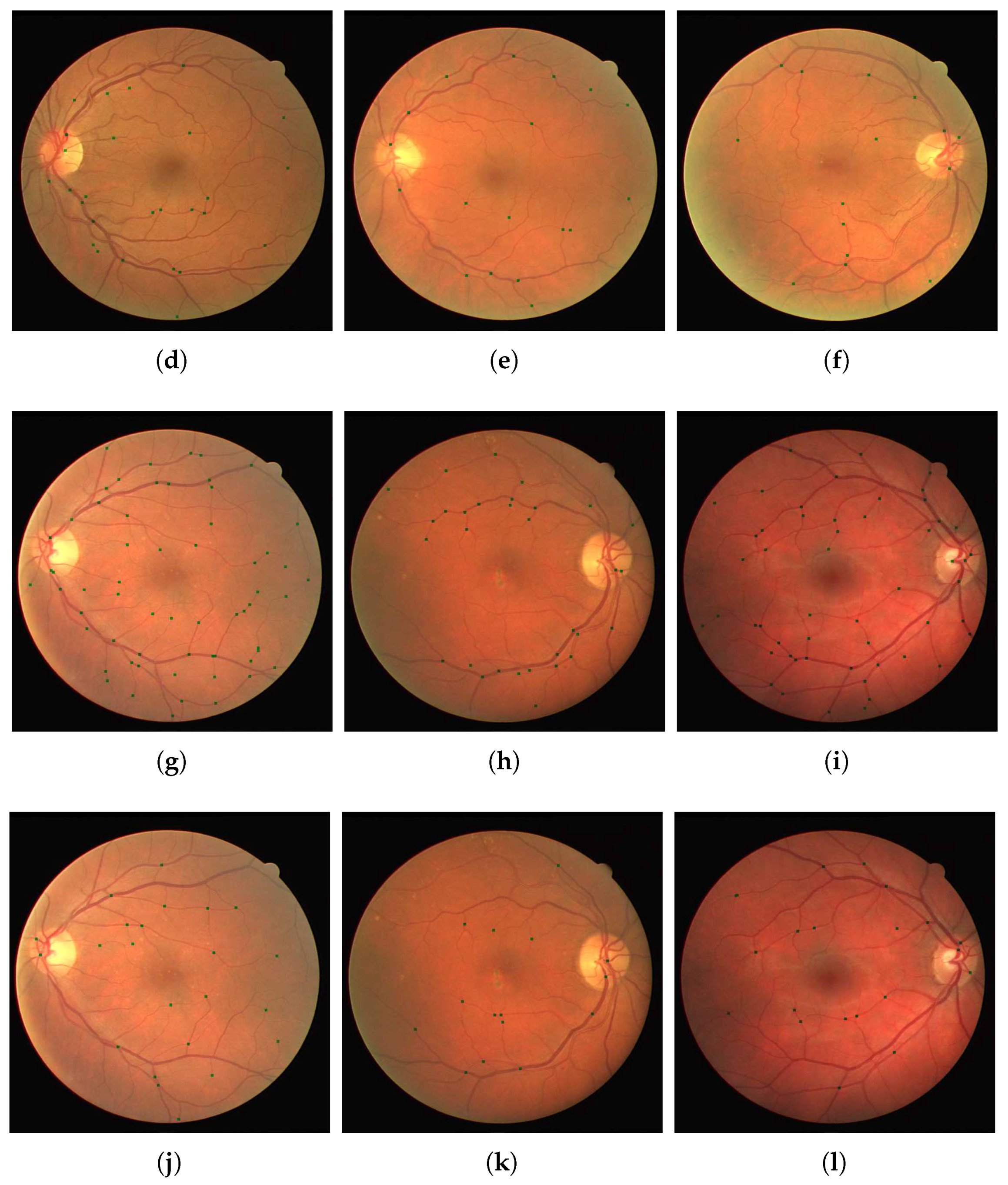 Jimaging 04 00004 g008b