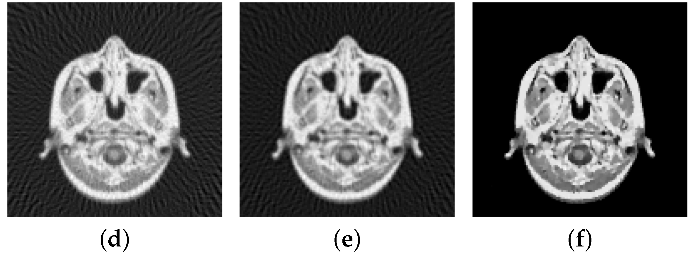 Jimaging 04 00012 g016b