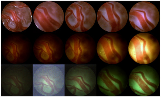 Jimaging 04 00024 g0a1 550