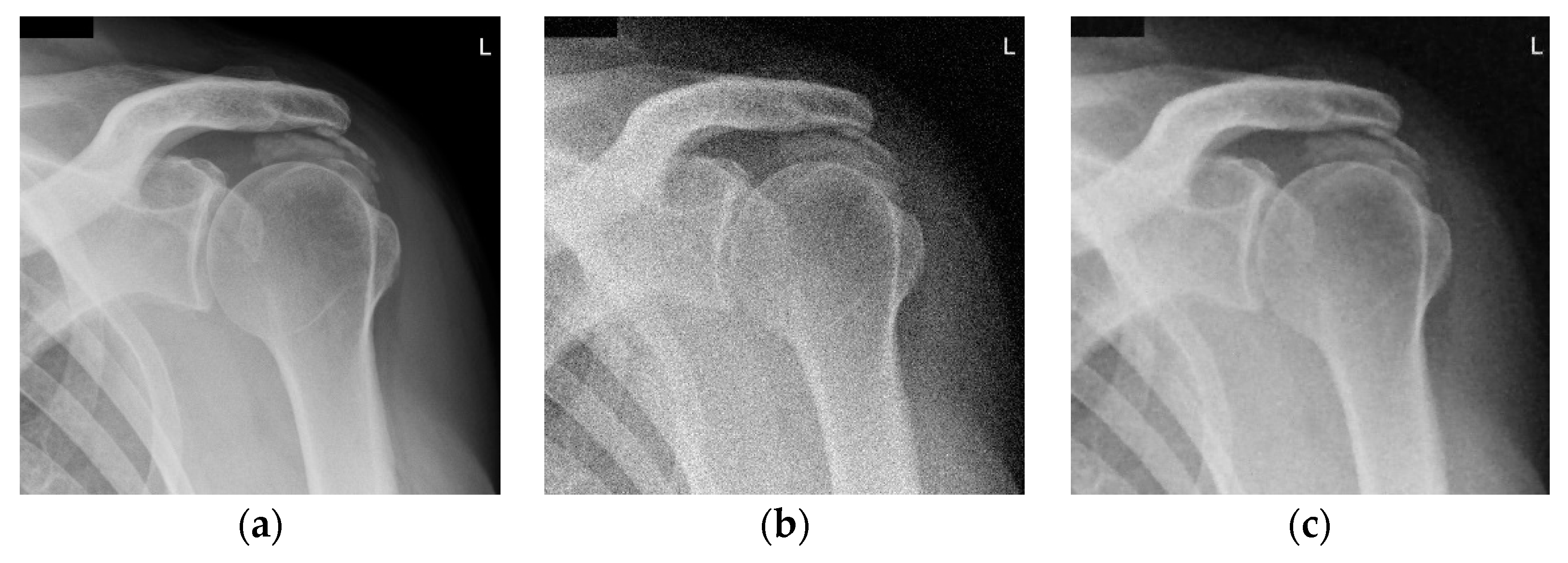 Jimaging 04 00034 g003a