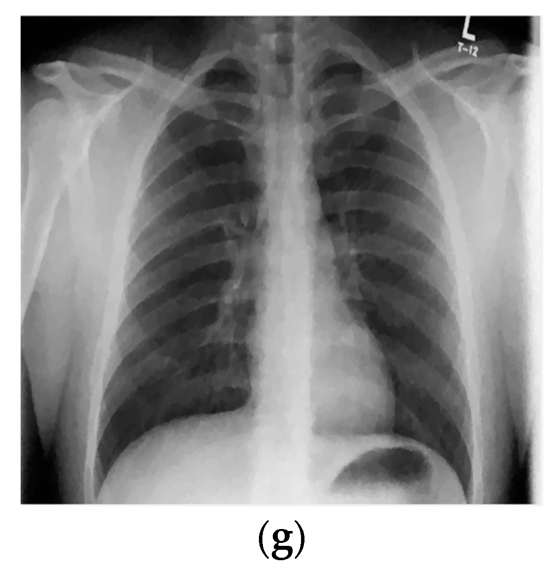 Jimaging 04 00034 g004b