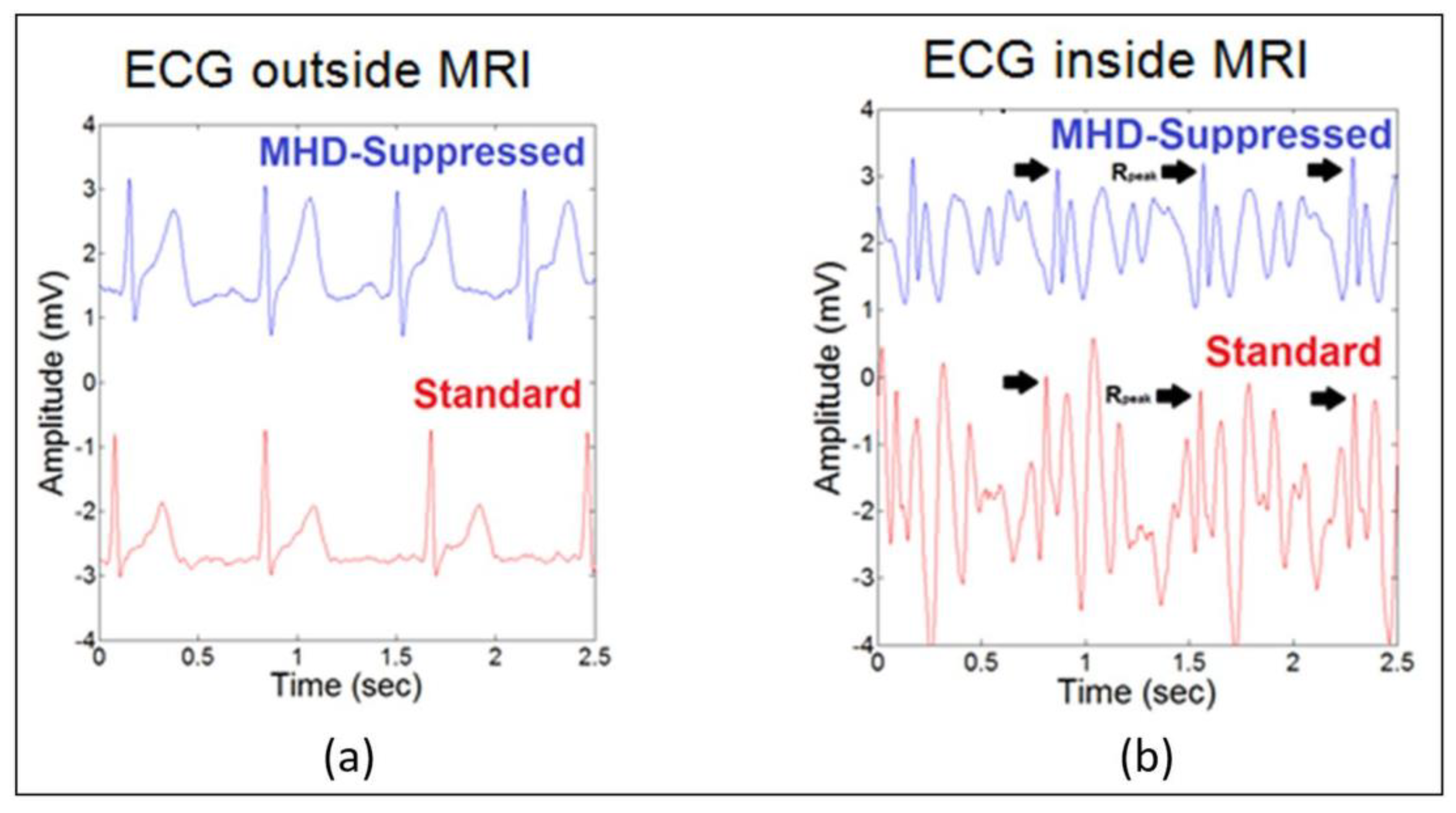 Jimaging 04 00094 g004 Jimaging 04 00094 g004