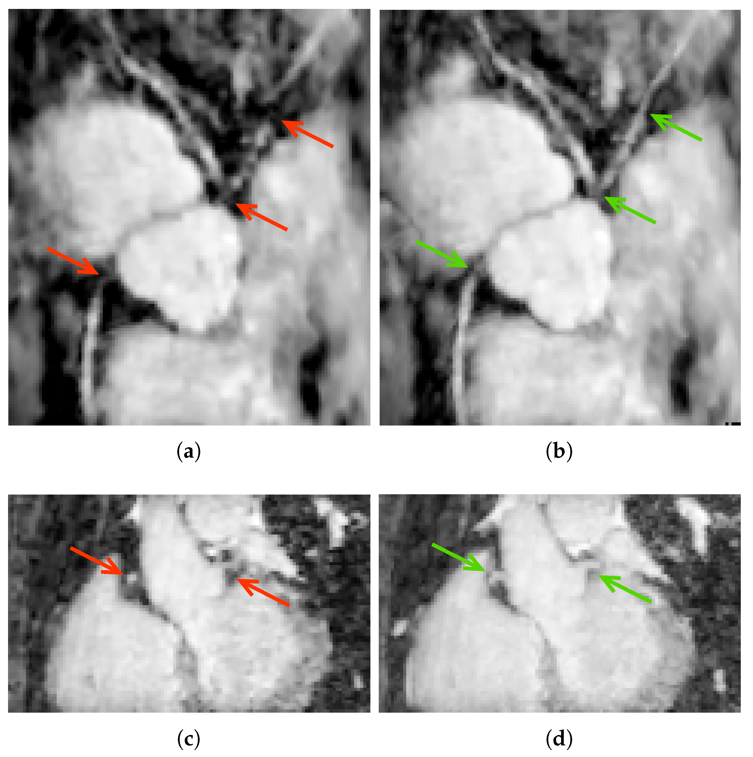 Jimaging 04 00124 g005