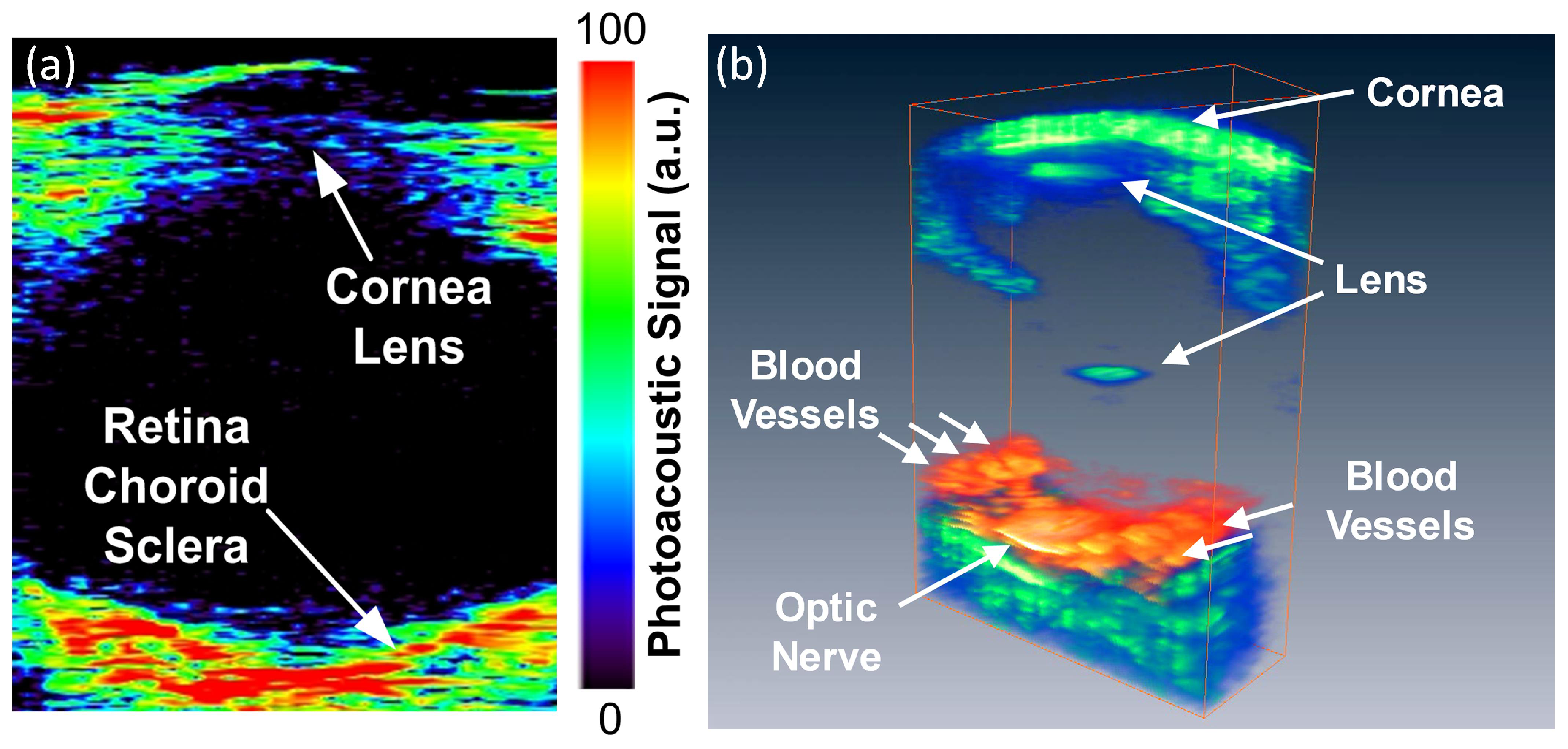 Jimaging 04 00149 g005 Jimaging 04 00149 g005