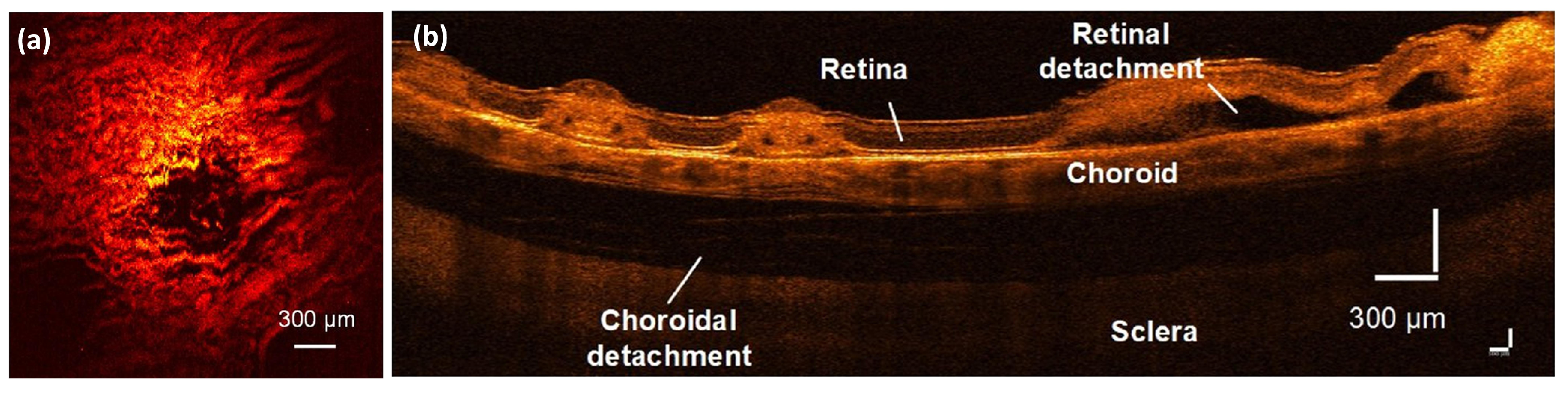Jimaging 04 00149 g010 Jimaging 04 00149 g010