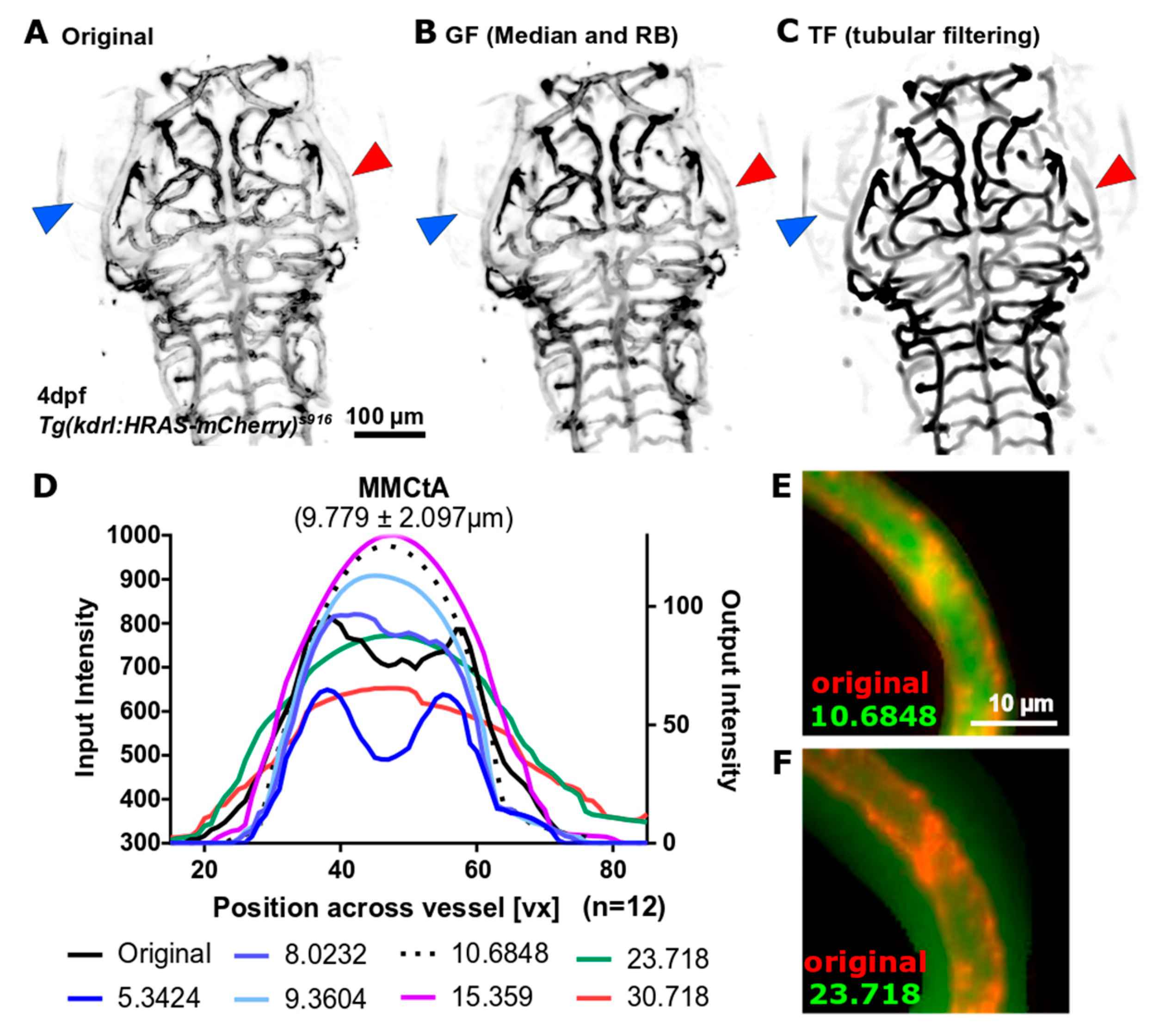 Jimaging 05 00014 g004