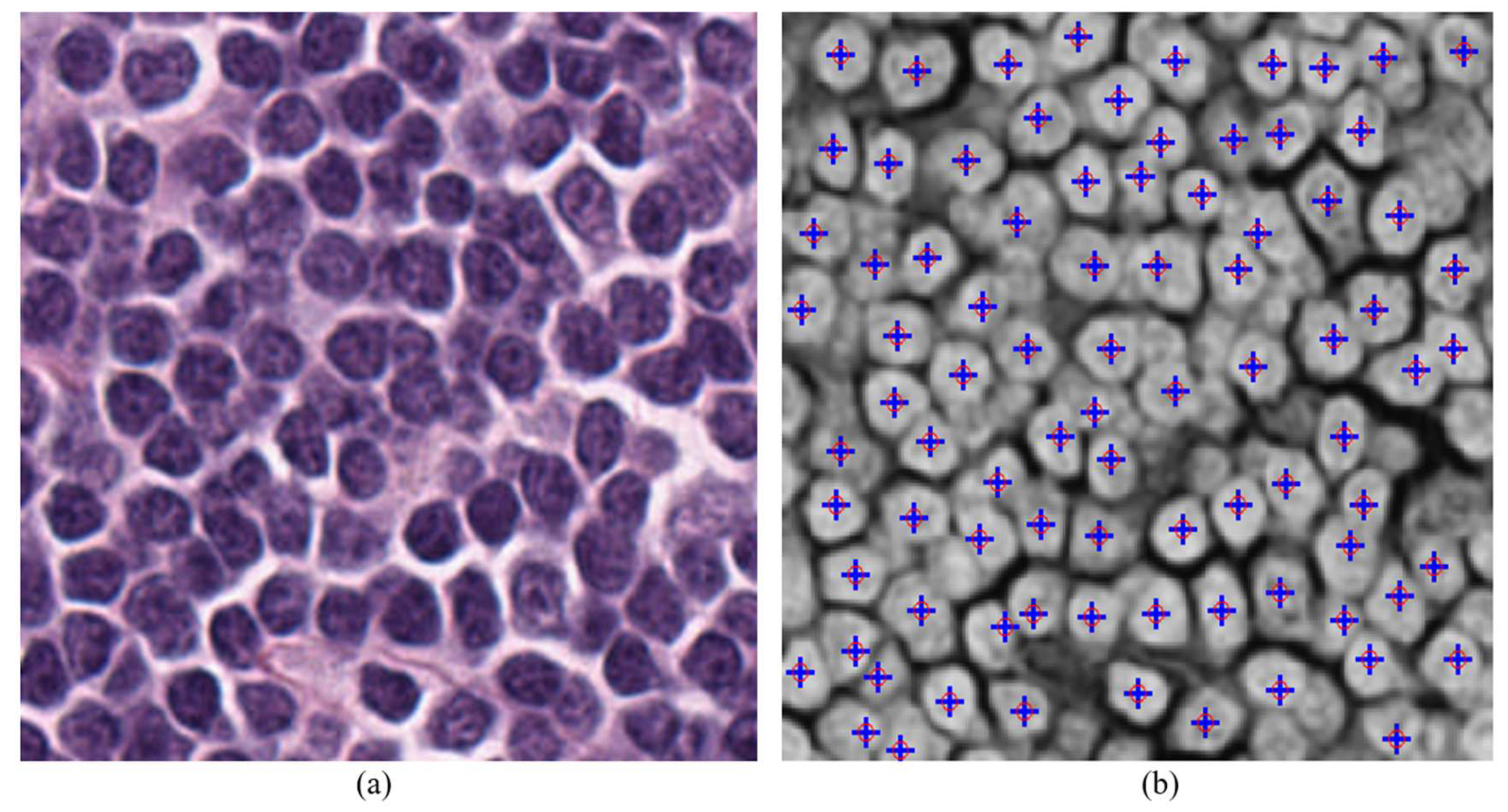 Jimaging 05 00021 g013