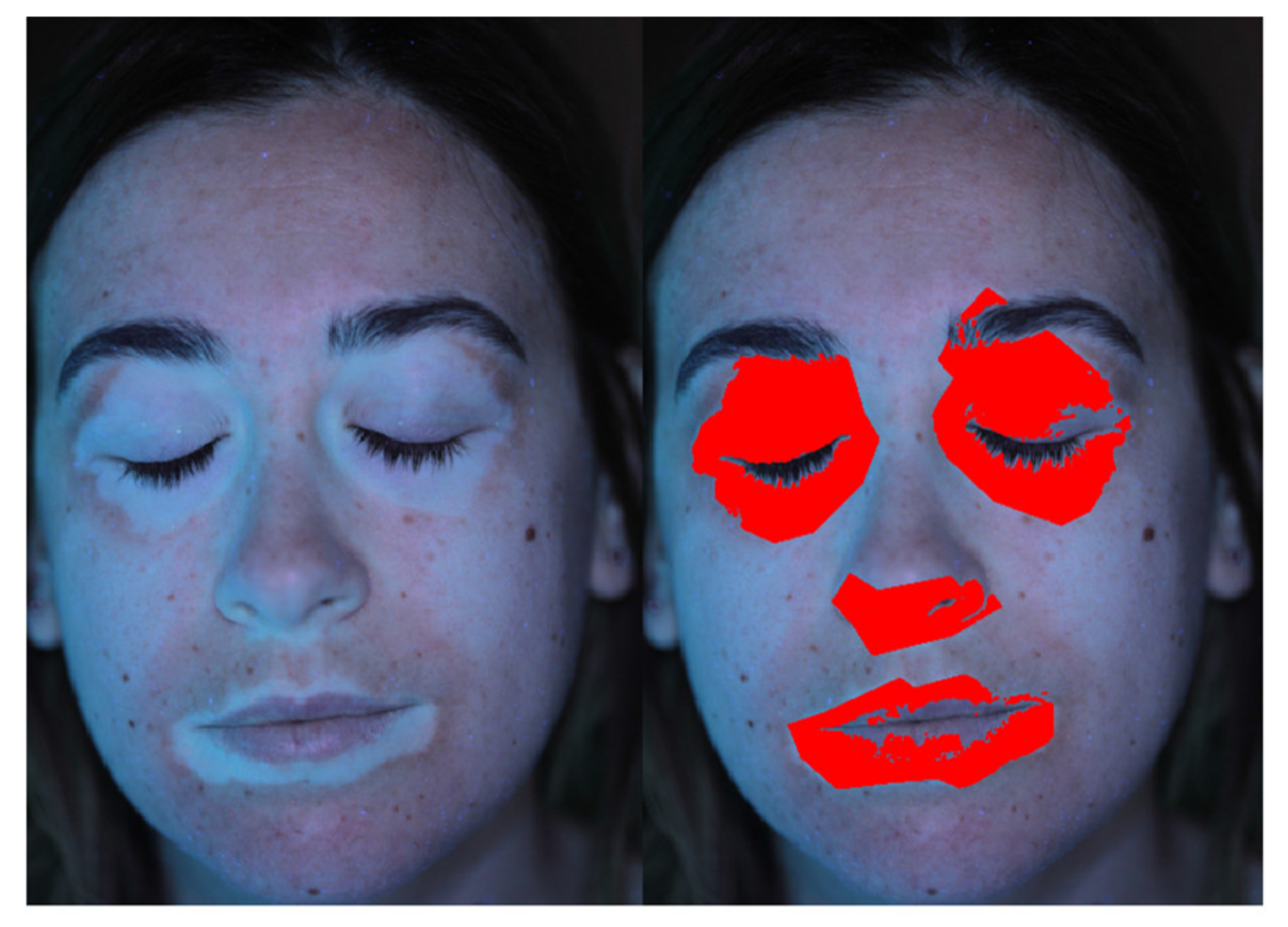 Jimaging 06 00014 g011