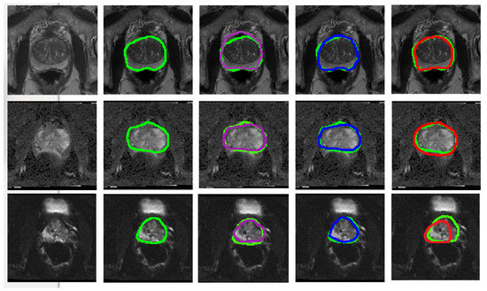 Jimaging 06 00083 g0a1