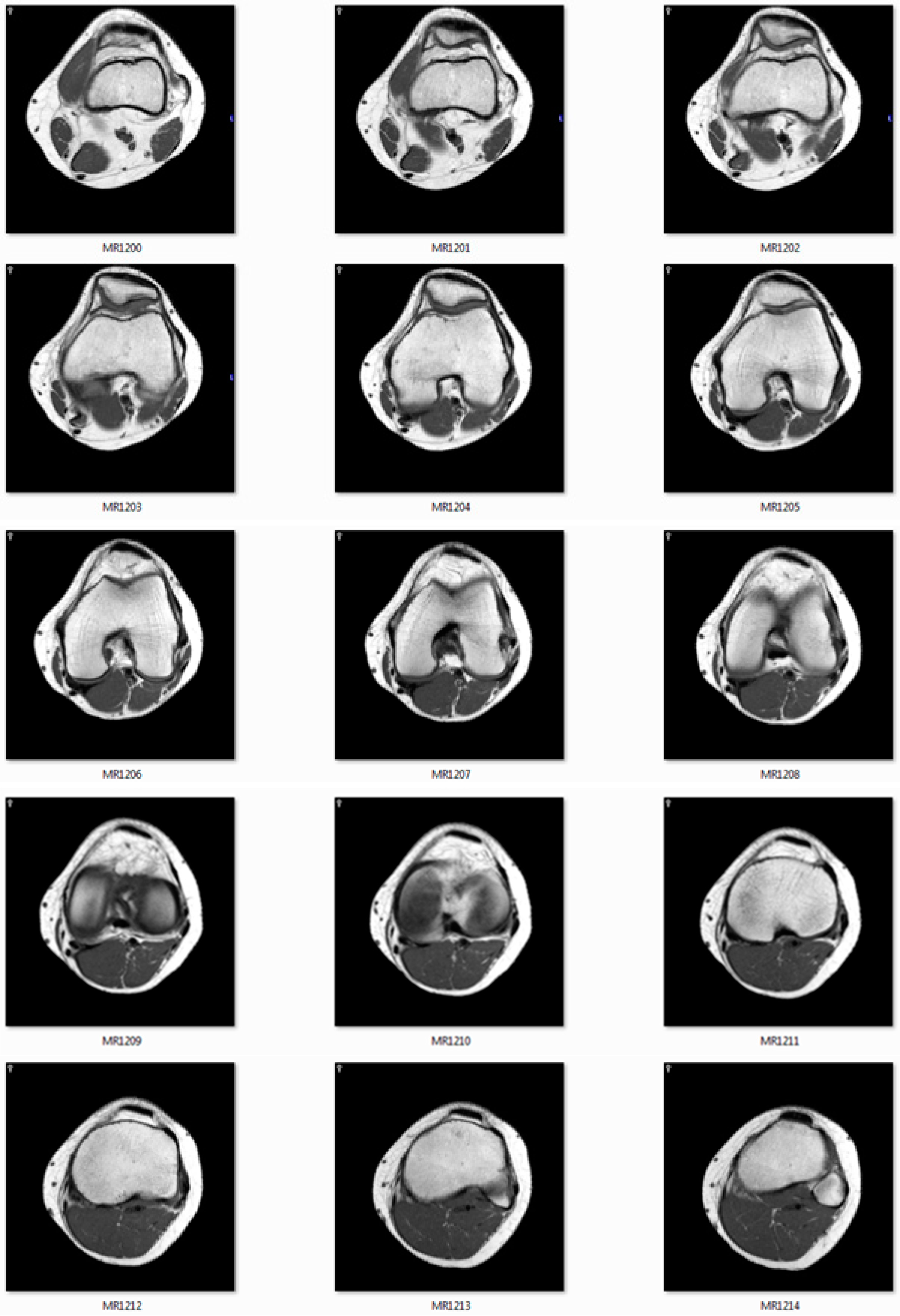 Jimaging 06 00088 g011a