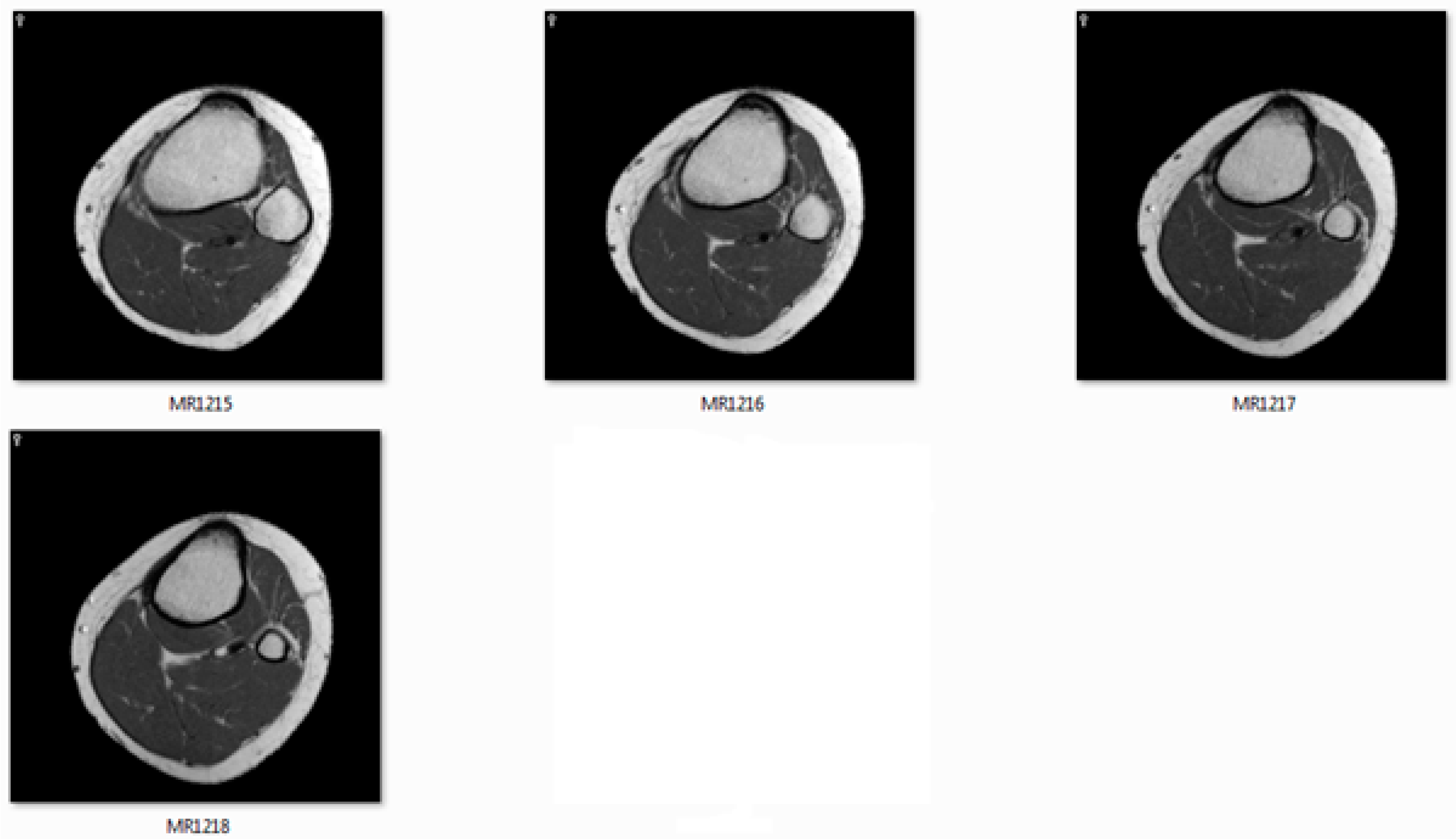 Jimaging 06 00088 g011b