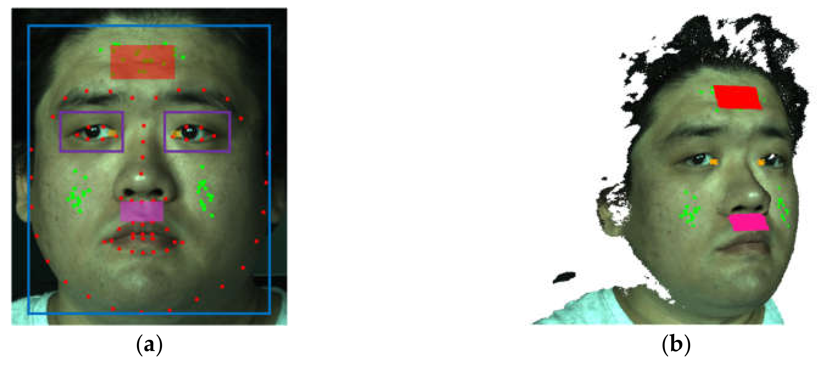 Jimaging 06 00123 g004 Jimaging 06 00123 g004