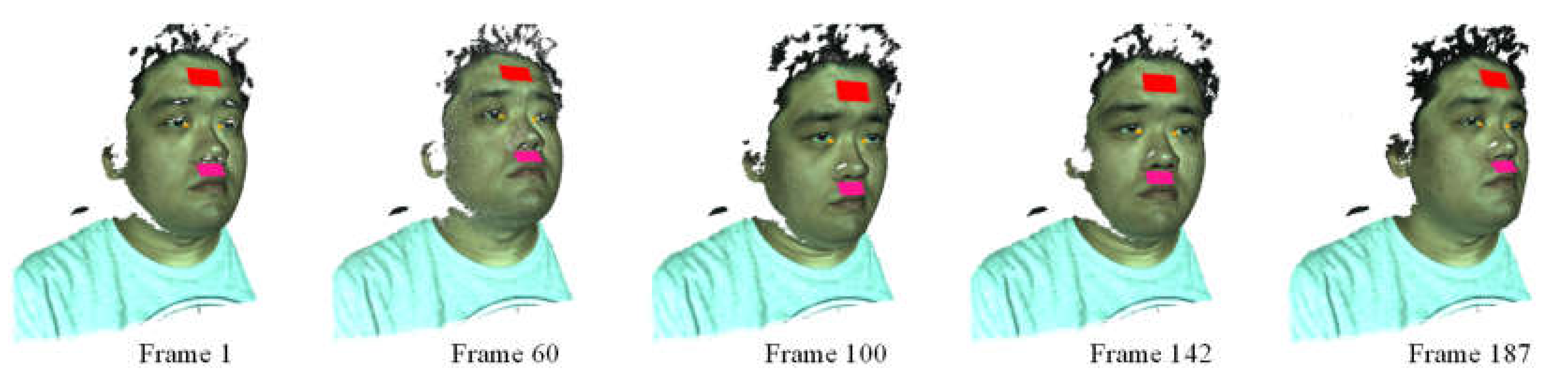 Jimaging 06 00123 g005 Jimaging 06 00123 g005