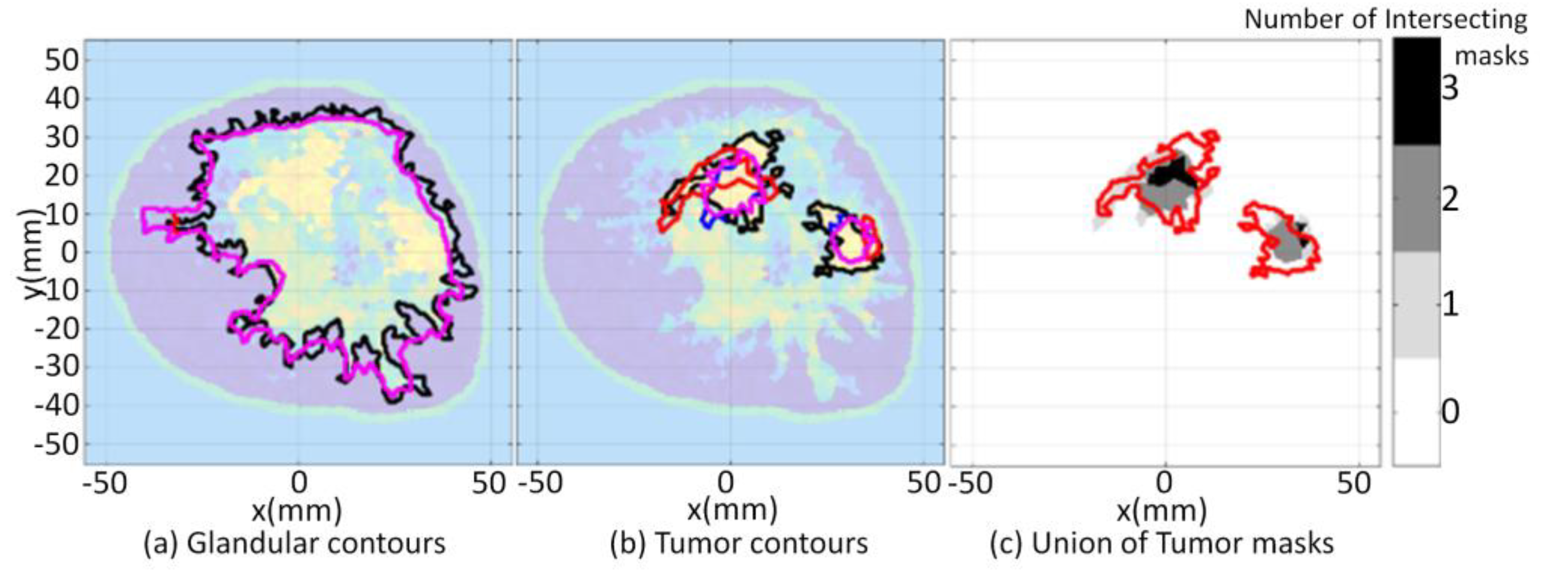 Jimaging 07 00005 g012 Jimaging 07 00005 g012
