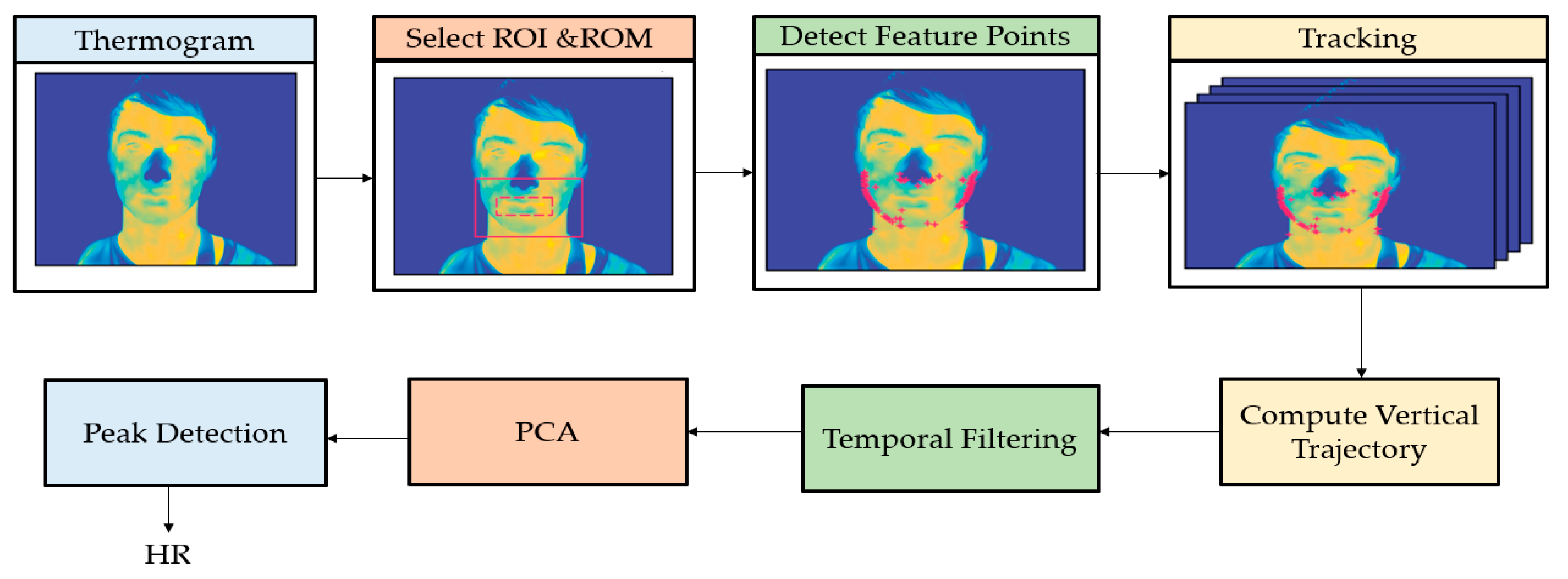 Jimaging 07 00028 g007 Jimaging 07 00028 g007