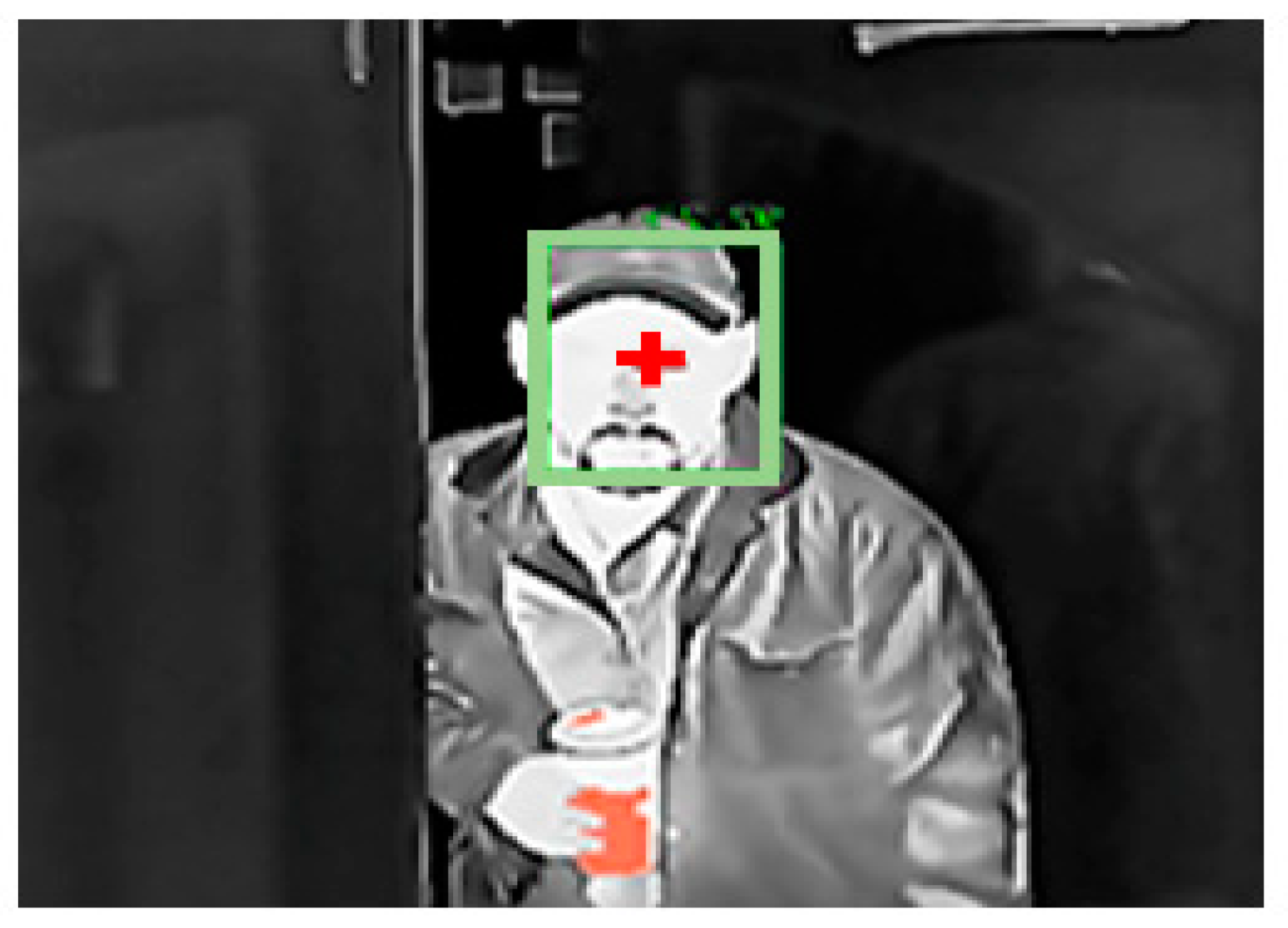 Jimaging 07 00028 g010 Jimaging 07 00028 g010