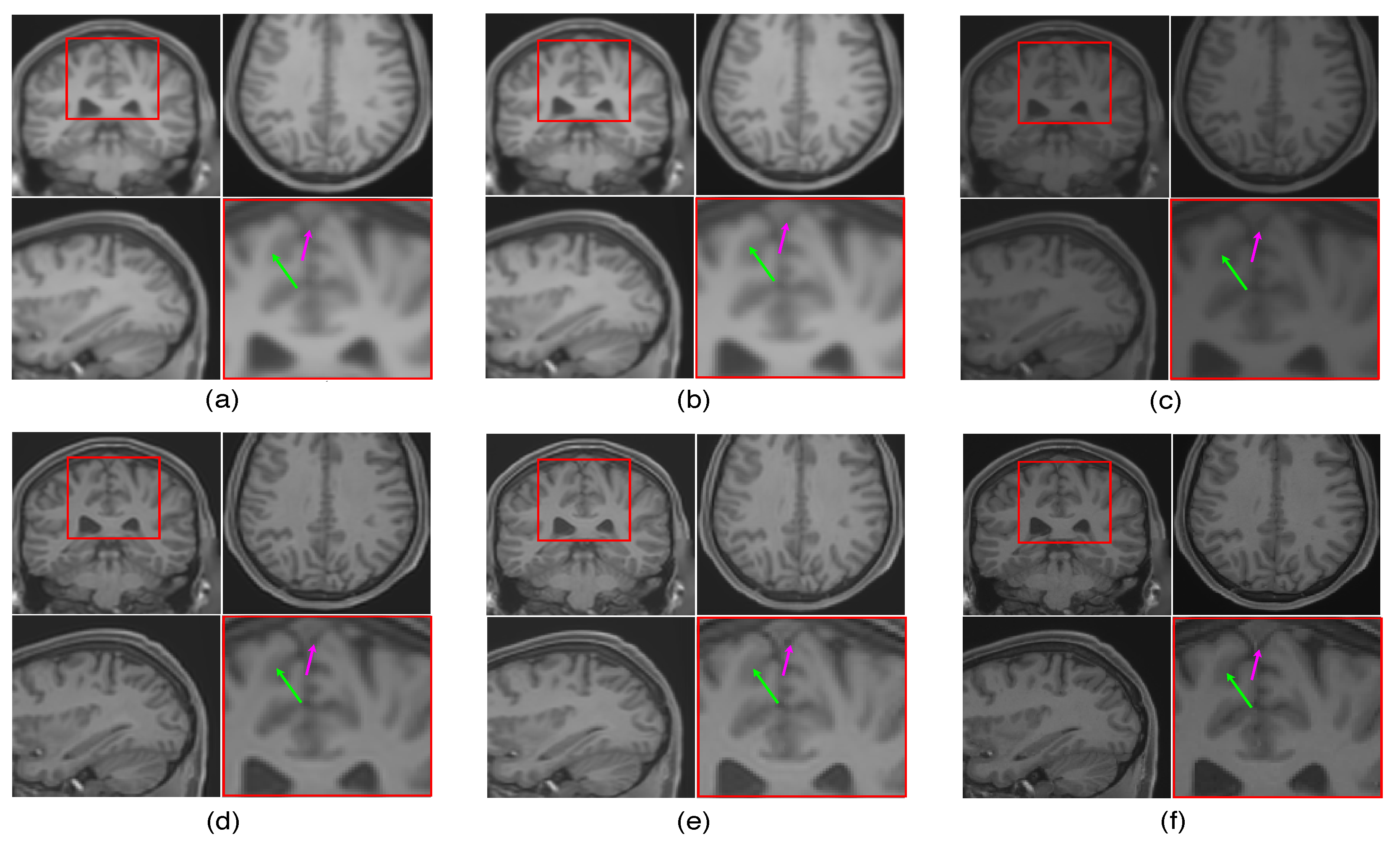 Jimaging 07 00101 g009