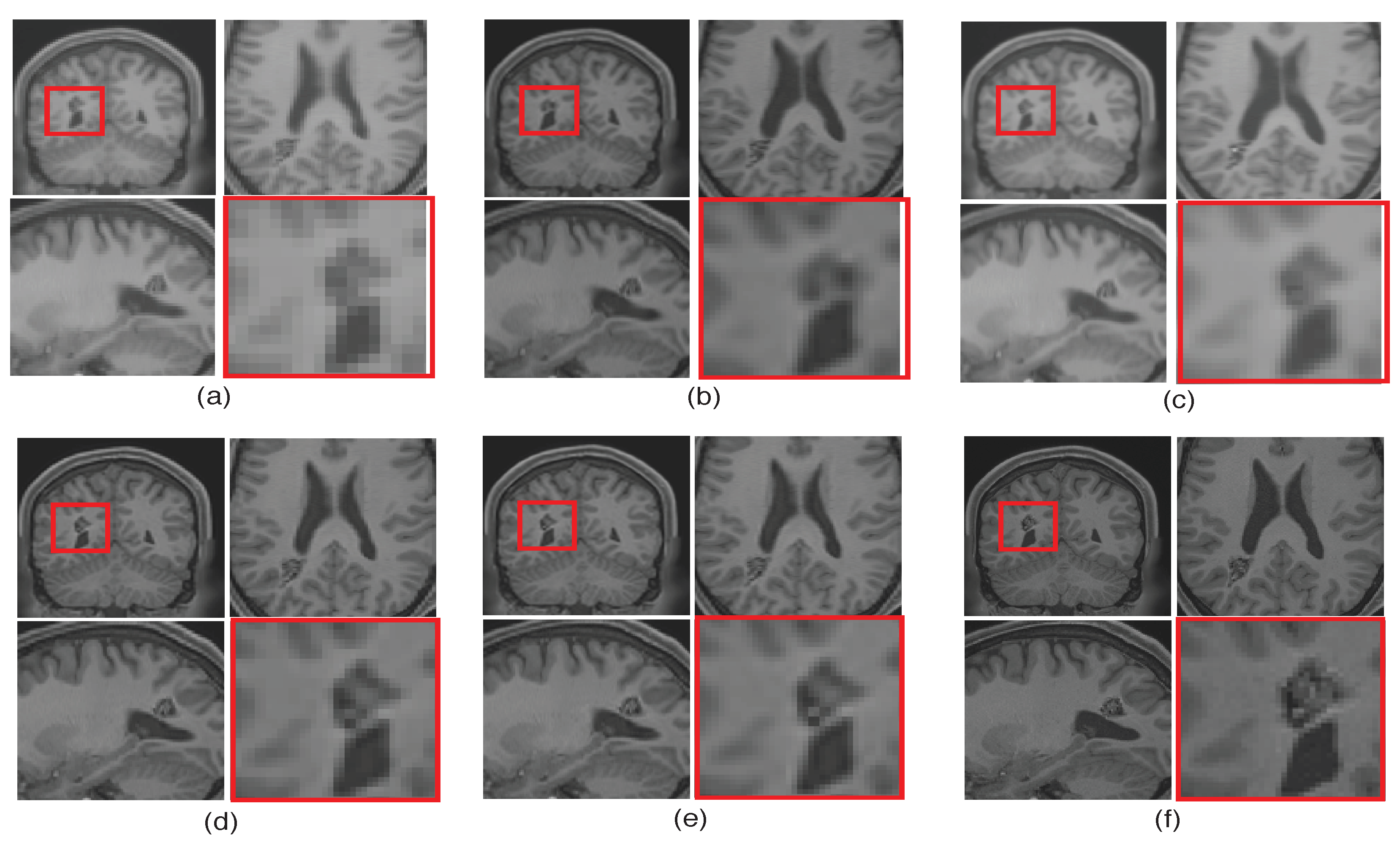 Jimaging 07 00101 g011