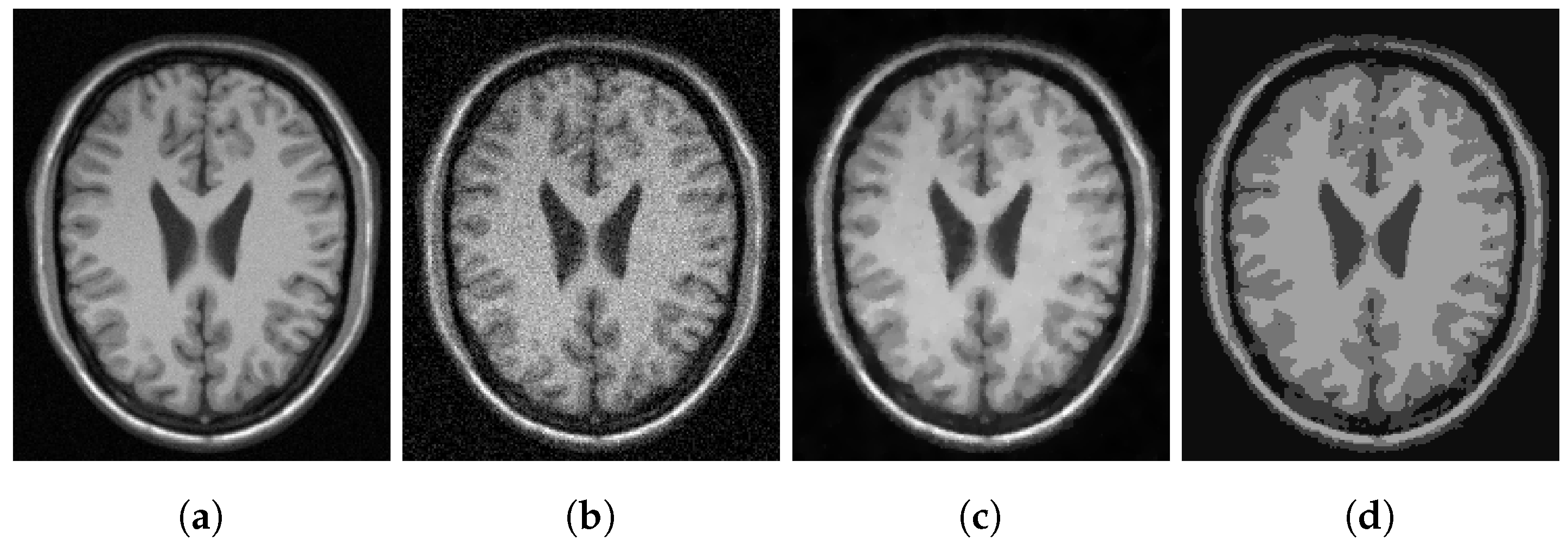 Jimaging 07 00228 g004a