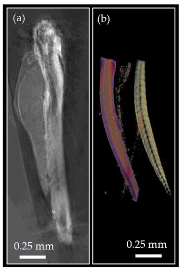 Jimaging 07 00252 g010 550