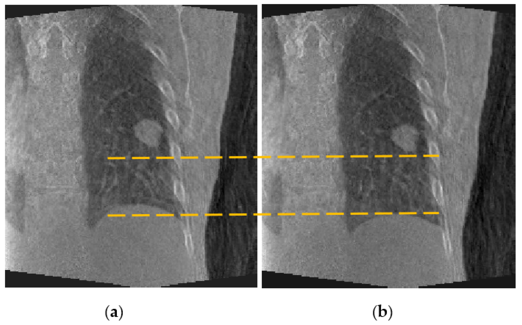 Jimaging 08 00017 g006
