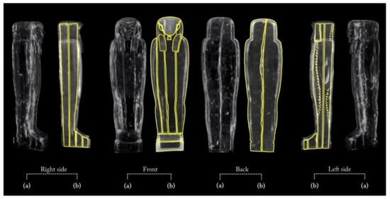 Jimaging 08 00039 g005 550