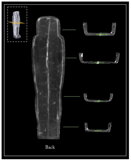 Jimaging 08 00039 g006 550