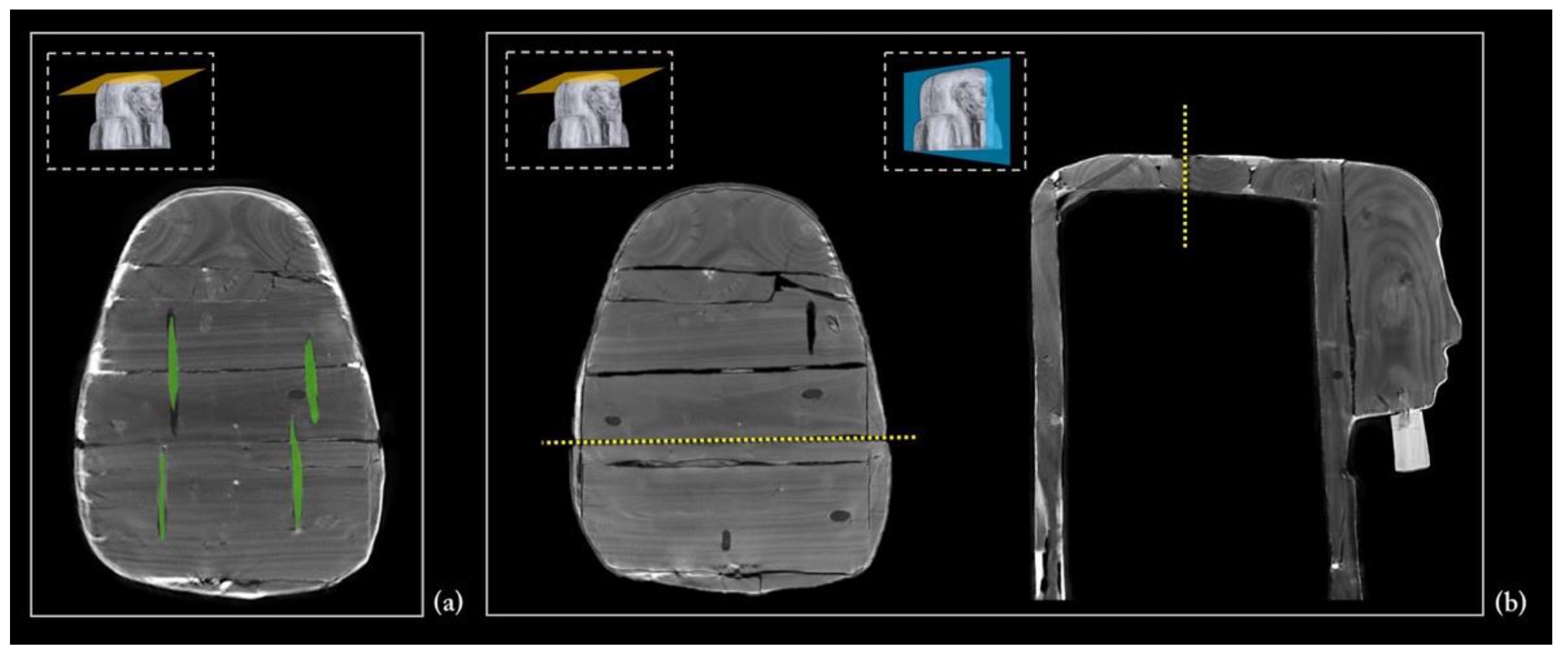 Jimaging 08 00039 g012