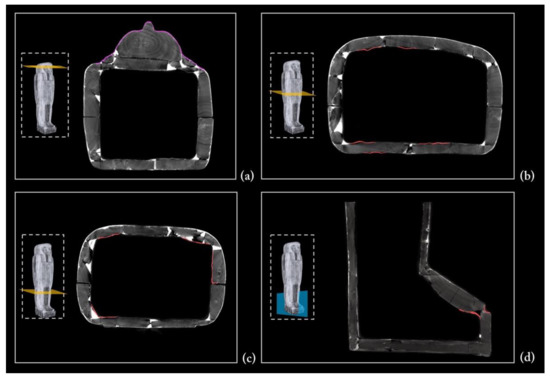 Jimaging 08 00039 g017 550