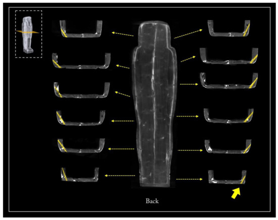 Jimaging 08 00039 g019 550