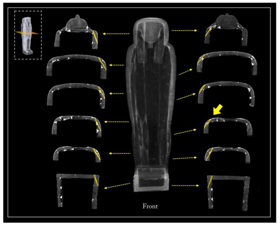 Jimaging 08 00039 g020 550