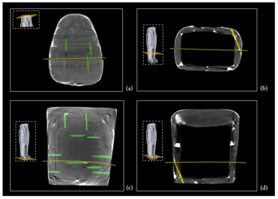 Jimaging 08 00039 g022 550