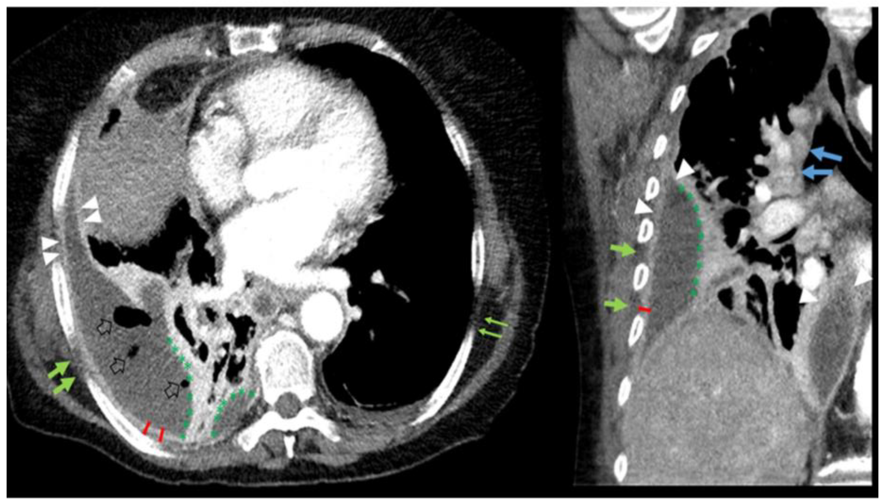 Jimaging 08 00050 g001
